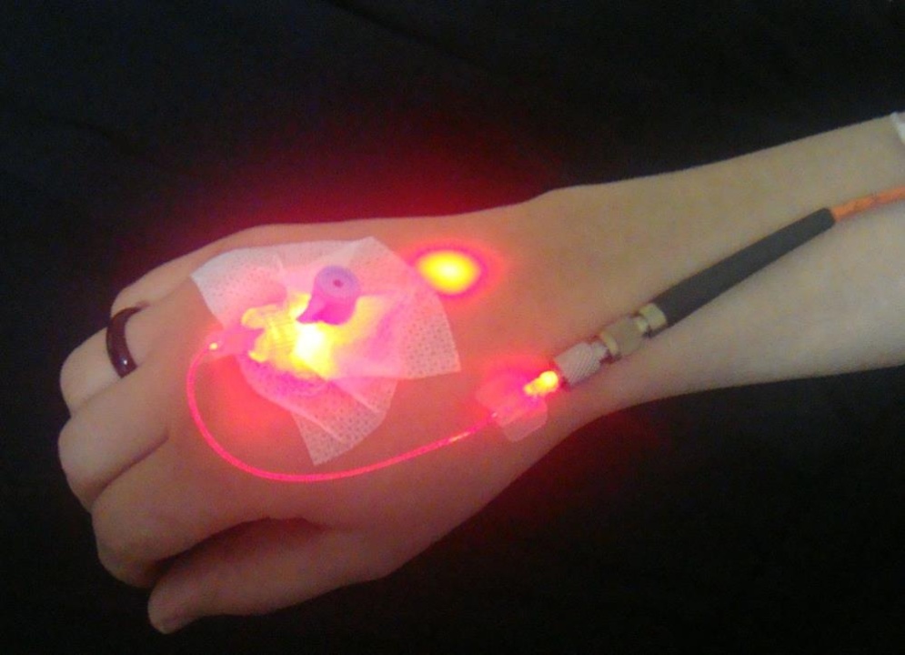 Ayak veya Kolda Şişlikler Varsa Dikkat