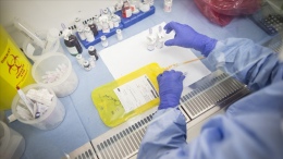 Az Sebze ve Meyve Tüketimi Kolorektal Kanseri Tetikliyor