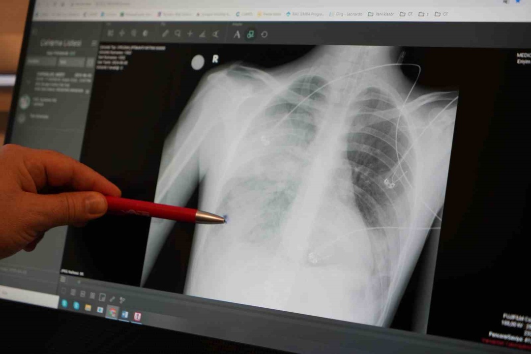 Bu belirtiler varsa doktora başvurun