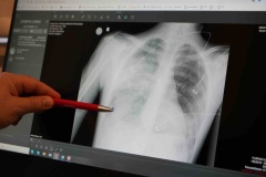 Bu belirtiler varsa doktora başvurun