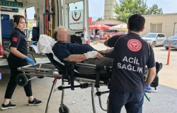 Fabrikada Feci Kaza