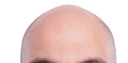 Kel Biri Saç Folikülü Testini Nasıl Verir? İşte Alternatif Yöntemler