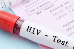 Türkiye, HIV Artış Hızında Üst Sıralarda