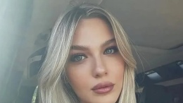 Yasemin Şefkatli'nin gözlerinde lens var mı, yok mu? Hayranları merak etti